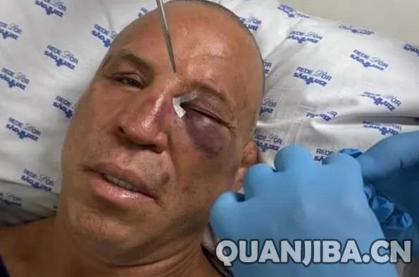 UFC资深选手万德雷·席尔瓦赛后爆发冲突,遭遇重击昏迷不醒